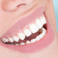 woman with white teeth smiling