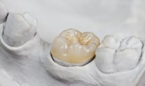 A simulated dental crown in a casted mold.